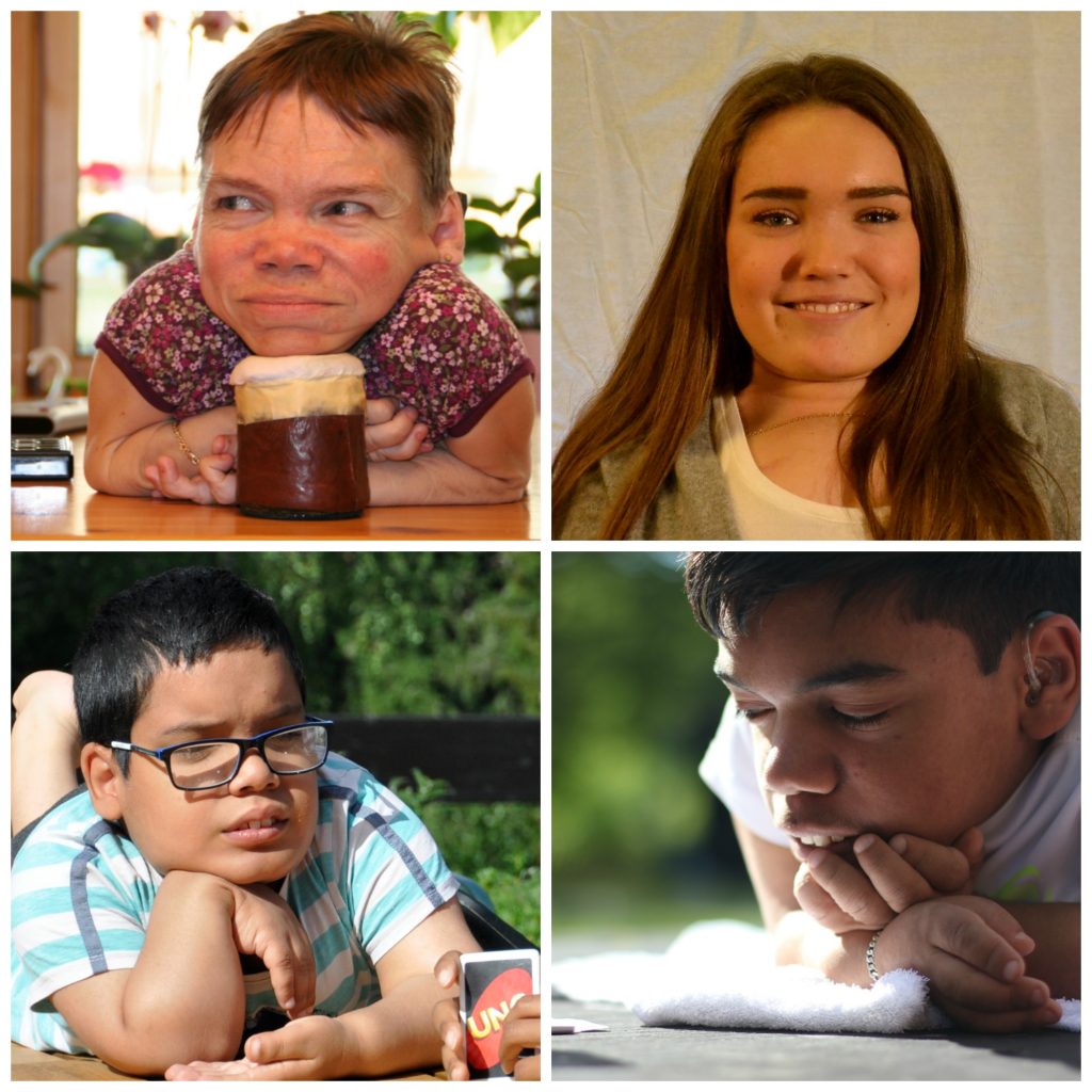 Morquios syndrom