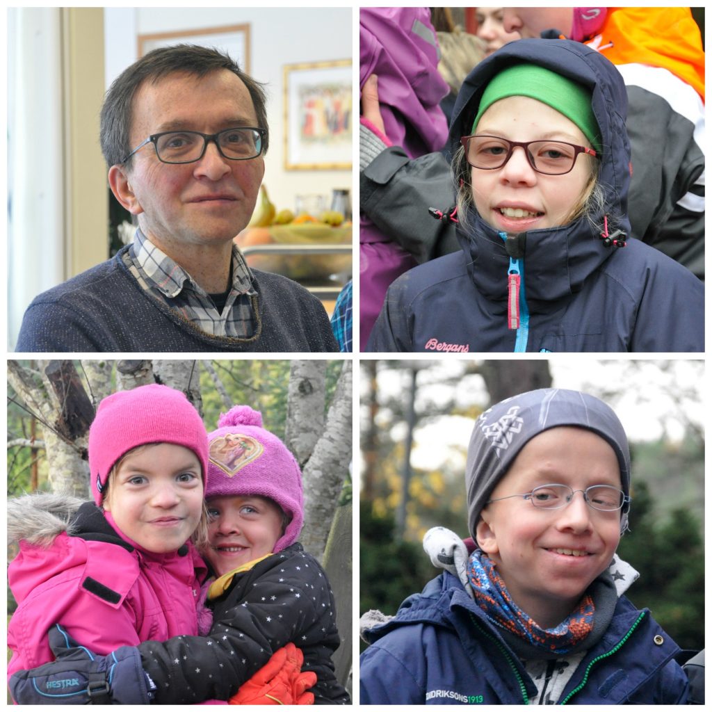 Noonans syndrom